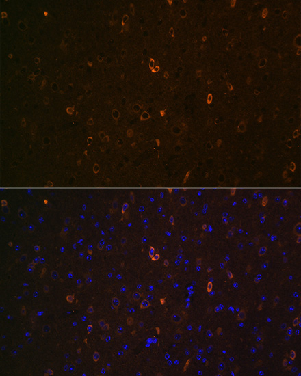 Immunofluorescence analysis of Mouse brain using ABCA2 Polyclonal Antibody at dilution of  1:100 (40x lens). Blue: DAPI for nuclear staining.