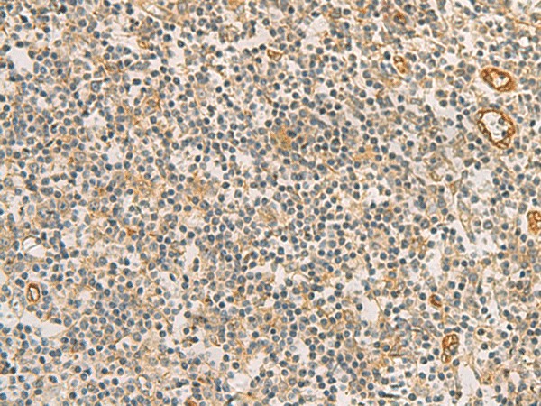 Immunohistochemistry of paraffin-embedded Human tonsil tissue  using RAB13 Polyclonal Antibody at dilution of 1:50(?200)