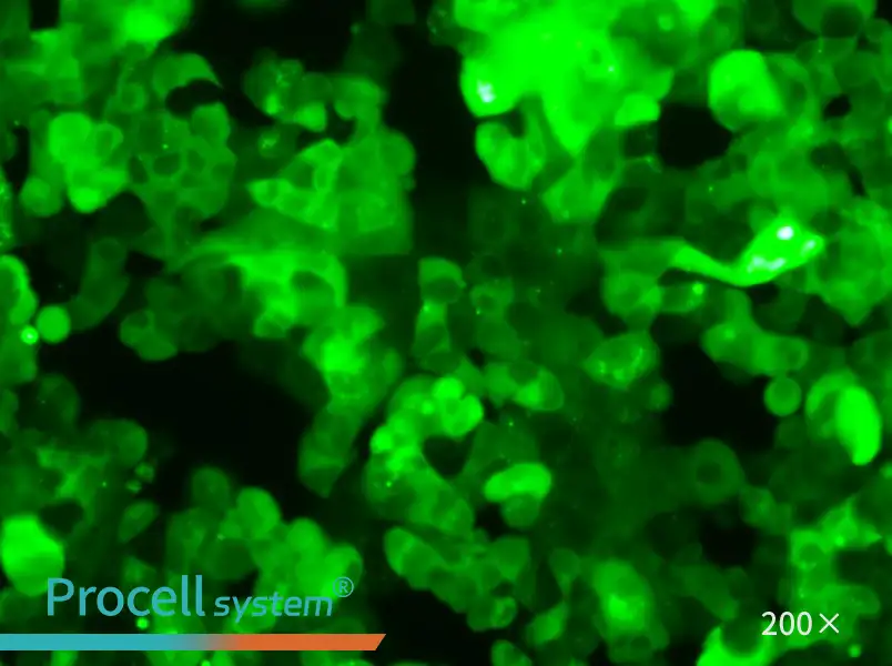 MCF-7-GFP - 6