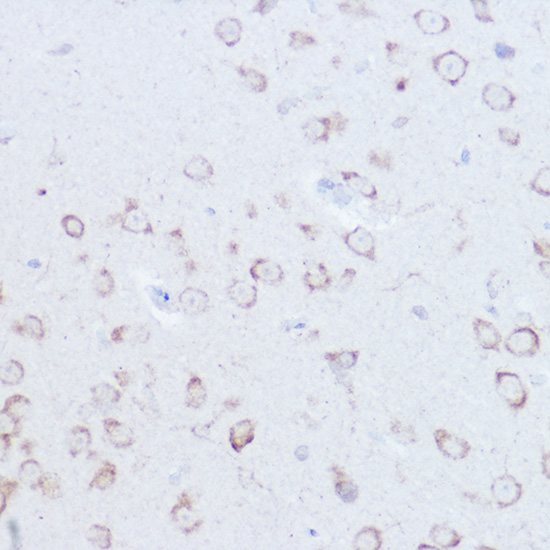 Immunohistochemistry of paraffin-embedded mouse brain using SSR2 Polyclonal Antibody at dilution of 1:100 (40x lens).Perform high pressure antigen retrieval with 10 mM citrate buffer pH 6.0 before commencing with IHC staining protocol.