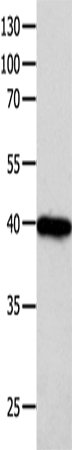 Western Blot analysis of 293T cell   using FOXL1  Polyclonal Antibody at dilution of 1:850