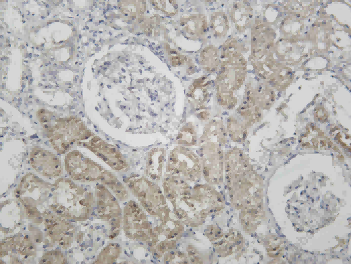 Recombinant Cathepsin B Monoclonal Antibody - 1