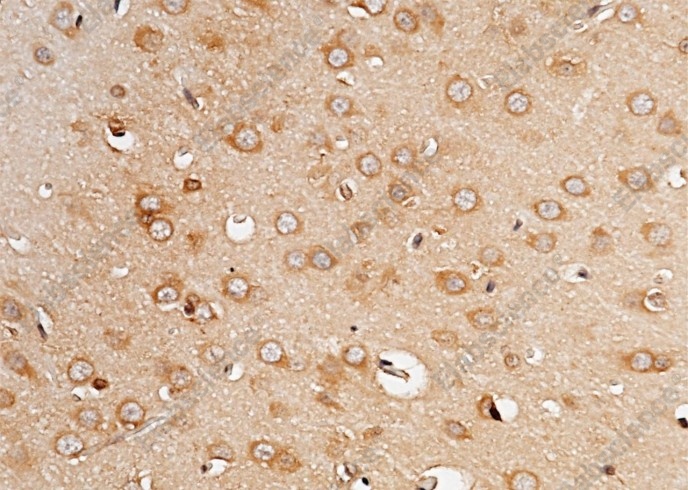 PCSK9 Monoclonal Antibody - 1