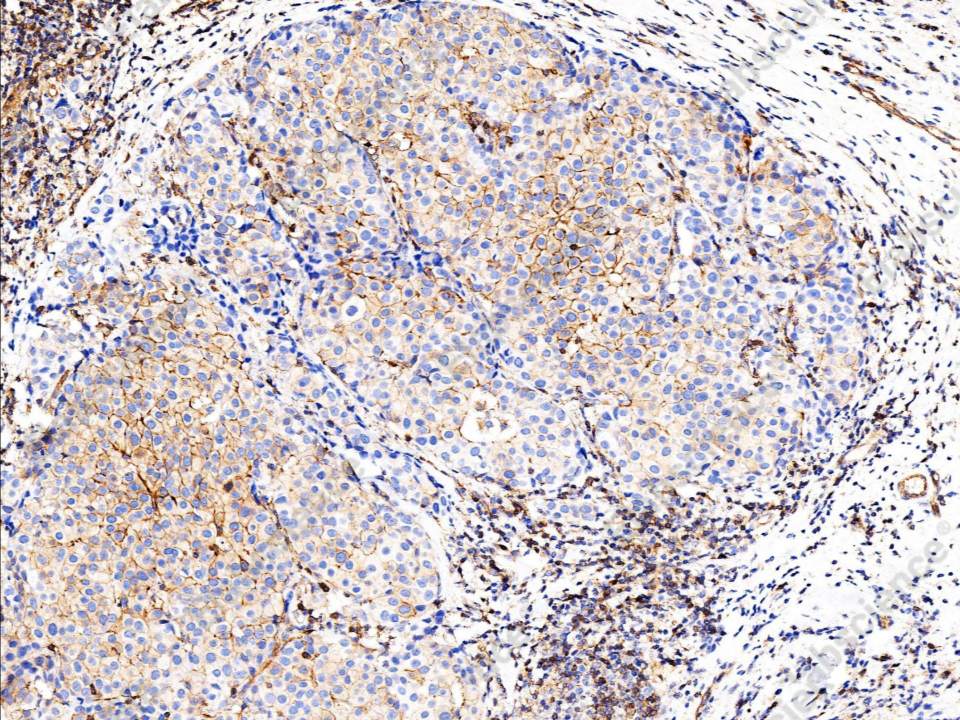 Recombinant Phospho-EGF Receptor (Tyr1068) Monoclonal Antibody - 1