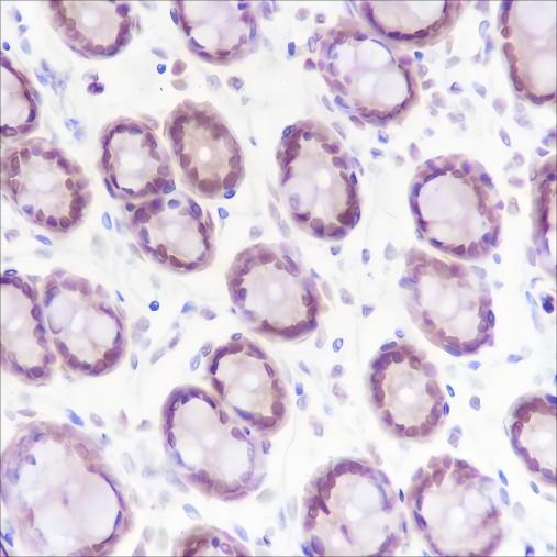 Recombinant KDM2A Monoclonal Antibody - 2