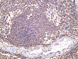Recombinant PHKG2 Monoclonal Antibody - 1
