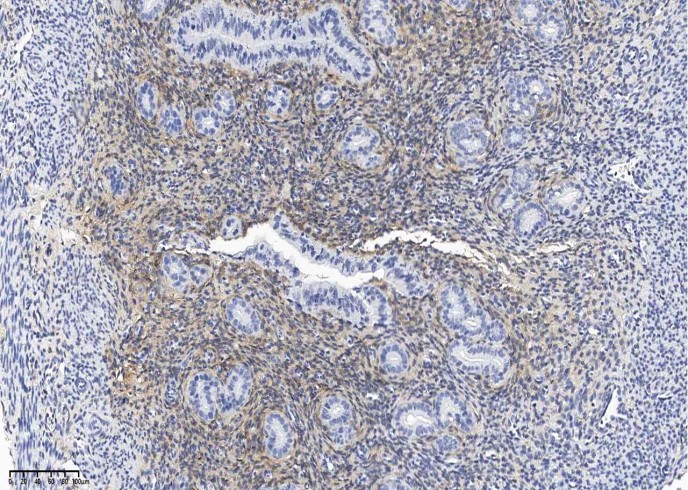 Recombinant PDGF alpha receptor/PDGFRA Monoclonal Antibody - small - 2