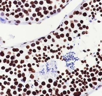 Recombinant Histone H4 (CT) Monoclonal Antibody - small - 4