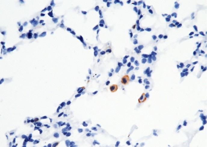Recombinant CD16-2/FCGR4 Monoclonal Antibody - small - 2