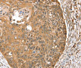 MORF4L1 Polyclonal Antibody - 3