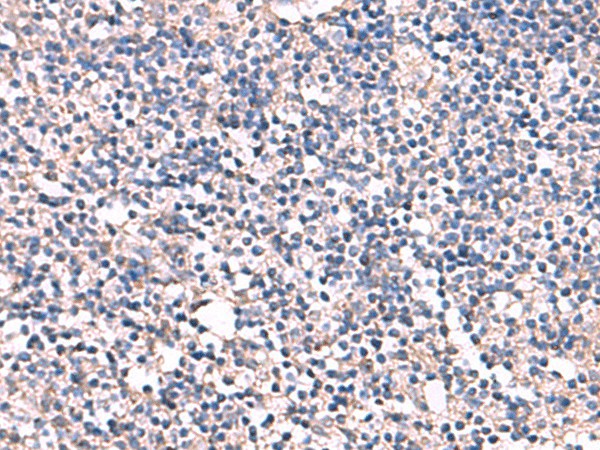 Immunohistochemistry of paraffin-embedded Human tonsil tissue  using ESM1 Polyclonal Antibody at dilution of 1:55(?200)