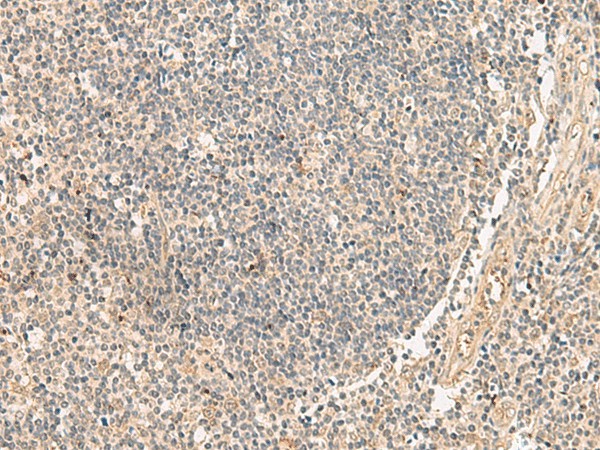 Immunohistochemistry of paraffin-embedded Human tonsil tissue  using PAF1 Polyclonal Antibody at dilution of 1:45(?200)