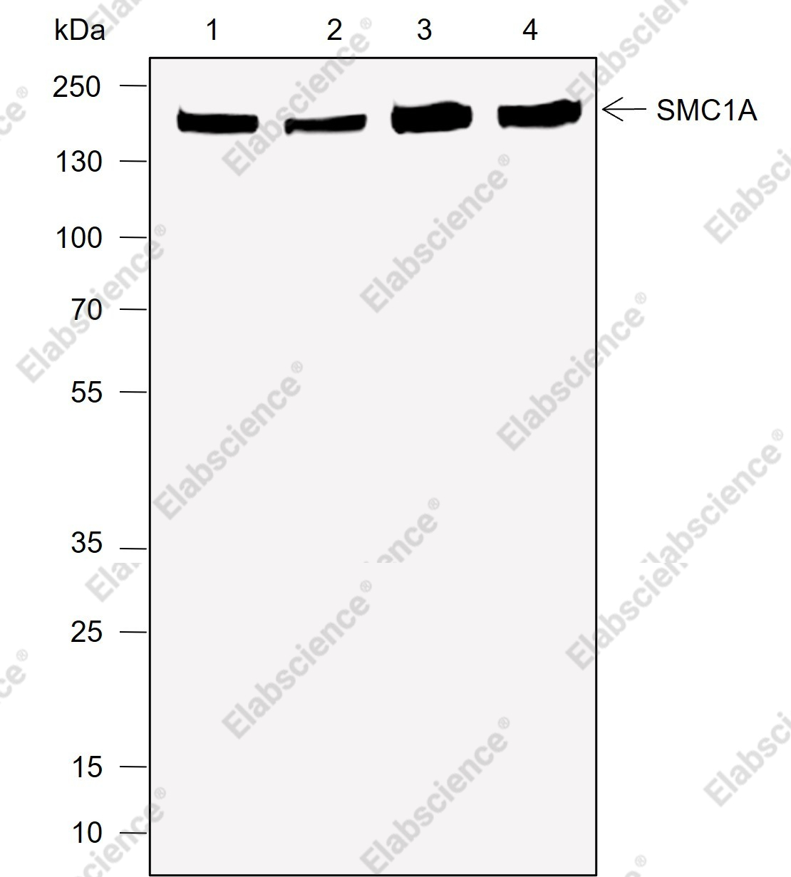 Recombinant SMC1A Monoclonal Antibody - 1