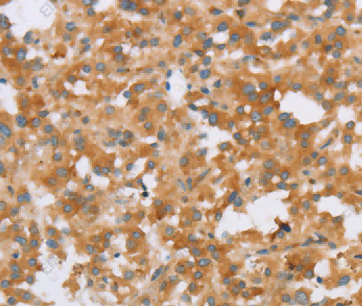 CRELD2 Polyclonal Antibody - 3