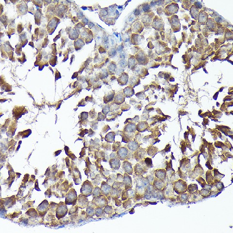 Immunohistochemistry of paraffin-embedded mouse testis using MTHFD1L Polyclonal antibody at dilution of 1:200 (40x lens).Perform high pressure antigen retrieval with 10 mM citrate buffer pH 6.0 before commencing with IHC staining protocol.