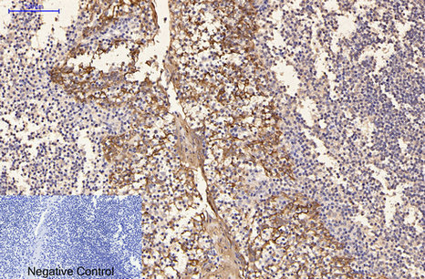 Immunohistochemistry of paraffin-embedded Human tonsil tissue using CK-16 Monoclonal Antibody at dilution of 1:200.