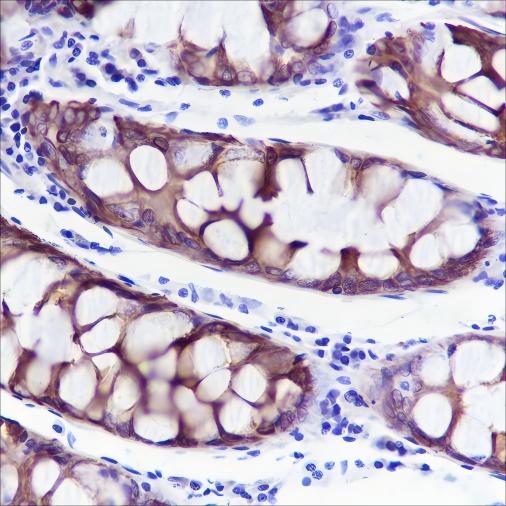 Recombinant Keratin 20 Monoclonal Antibody - small - 2