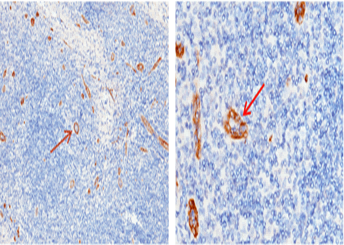 Recombinant ADAM15/MDC15 Monoclonal Antibody - small - 3