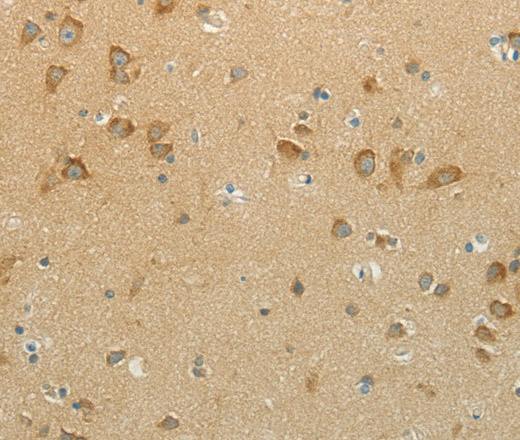 Immunohistochemistry of paraffin-embedded Human brain  using NDRG3 Polyclonal Antibody at dilution of 1:70