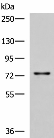 Western blot analysis of Rat liver tissue lysate  using TGFBI Polyclonal Antibody at dilution of 1:850