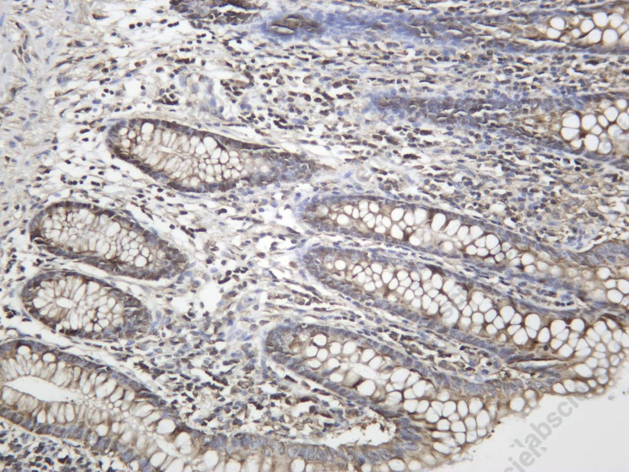 Recombinant Huntingtin Monoclonal Antibody - 1