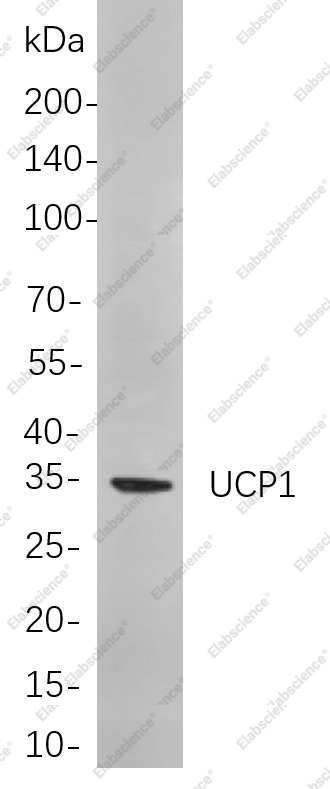 Recombinant UCP1 Monoclonal Antibody - 1