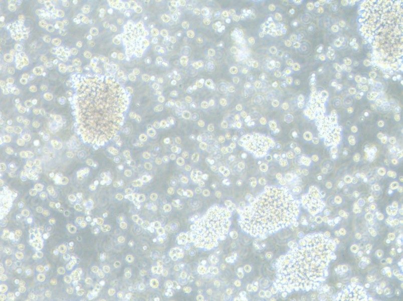 P3HR-1 Cell Complete Medium-searchlist-1