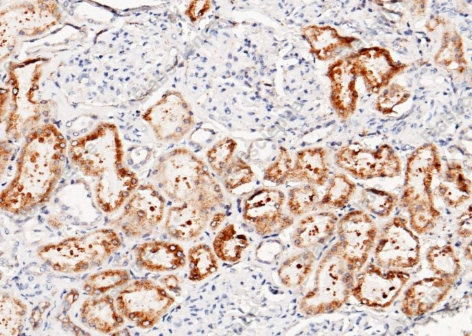 LRPAP1 Monoclonal Antibody - 1