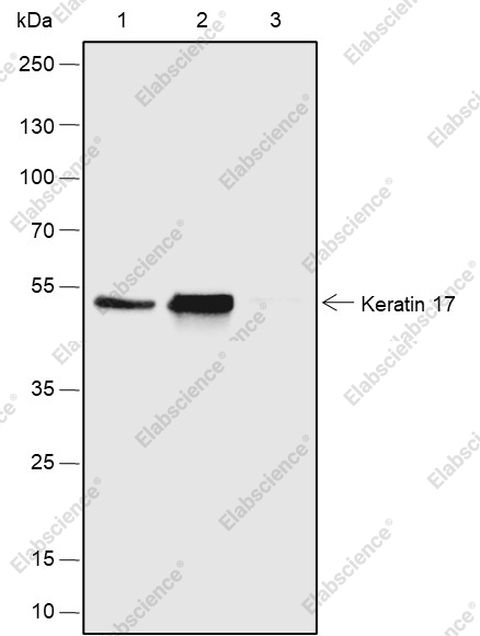 Recombinant Keratin 17 Monoclonal Antibody - 4