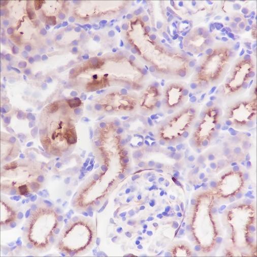 Recombinant Alpha B Crystallin Monoclonal Antibody - small - 7