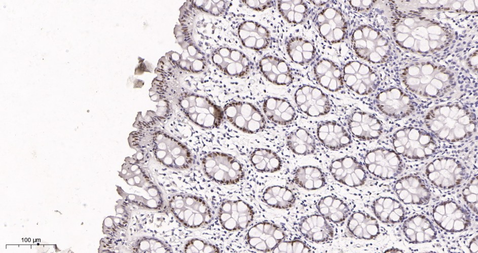 Recombinant KLF4 Monoclonal Antibody - small - 2