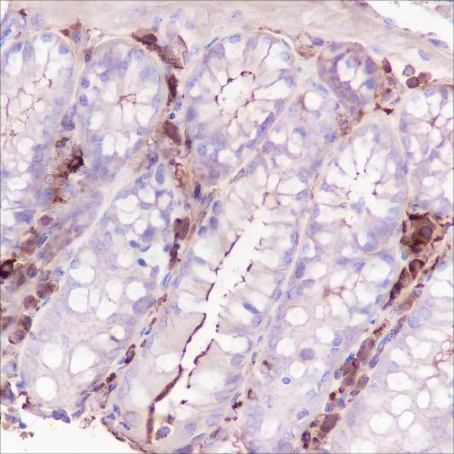 Recombinant CSF-1R Monoclonal Antibody - small - 3