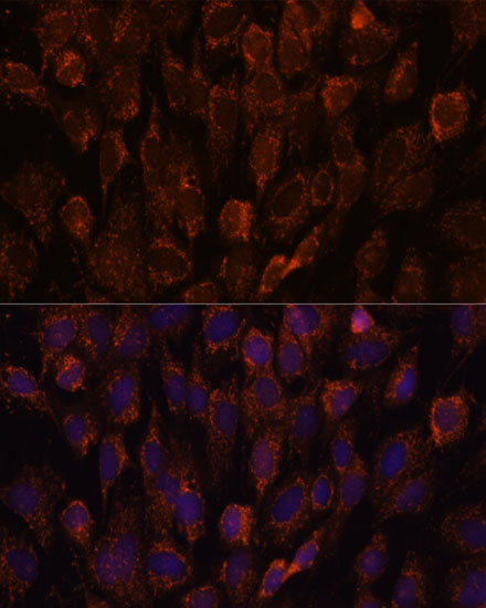 Immunofluorescence analysis of C6 cells using NSDHL Polyclonal Antibody at dilution of 1:100. Blue: DAPI for nuclear staining.