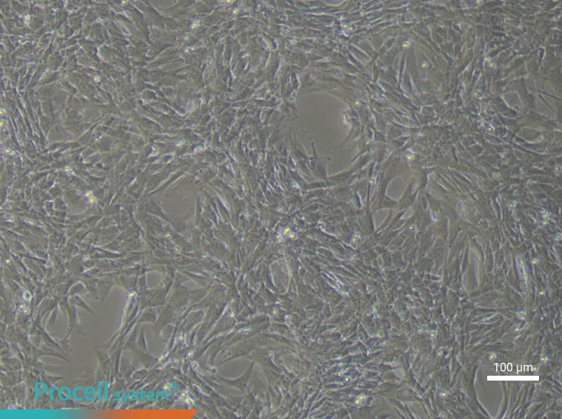 Rat Pulmonary Artery Smooth Muscle Cells (Primary cell immortalization)Rat Pulmonary Artery Smooth Muscle Cells (Primary cell immortalization) - 2
