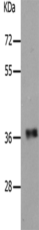 Western Blot analysis of Human fetal muscle tissue using PARD6A Polyclonal Antibody at dilution of 1:650