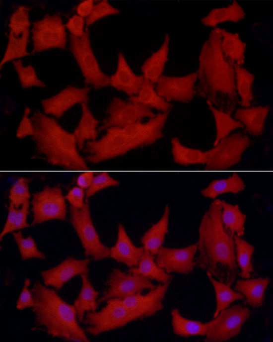 Immunofluorescence analysis of A-549 cells using [KO Validated] PTPN2 Polyclonal antibody at dilution of 1:250 (40x lens). Blue: DAPI for nuclear staining.