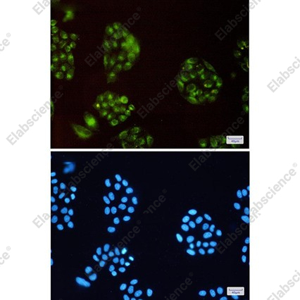 Recombinant ATP6V0D1 Monoclonal Antibody - 3