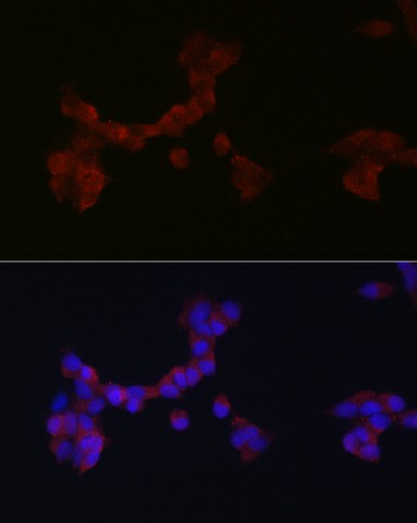 Immunofluorescence analysis of SH-SY5Y cells using DAB1 Polyclonal Antibody at dilution of 1:200 (40x lens). Blue: DAPI for nuclear staining.