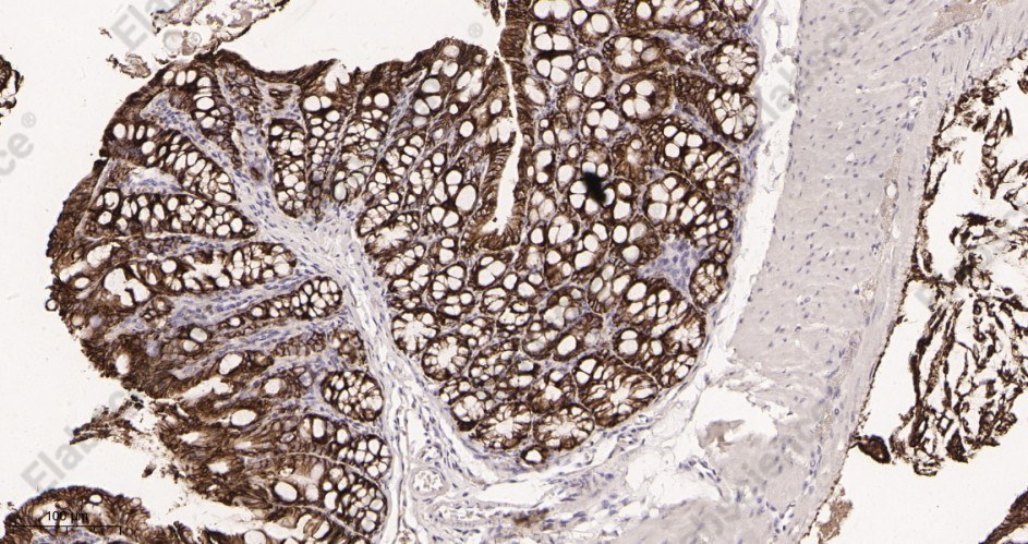 Recombinant EpCAM Monoclonal Antibody - 3