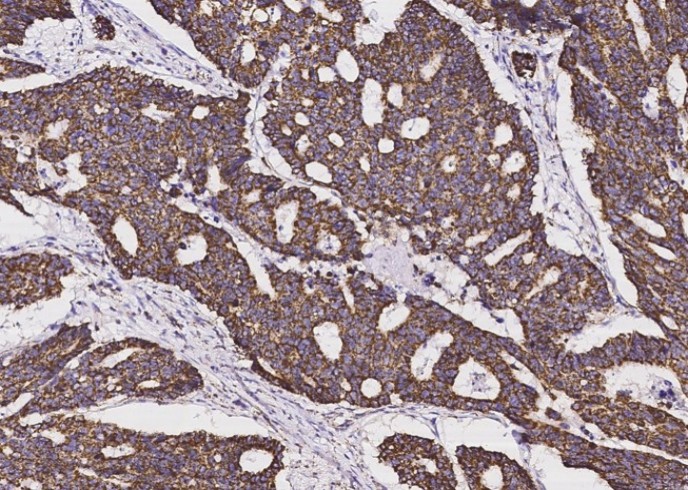 Recombinant SOD2 Monoclonal Antibody - small - 3