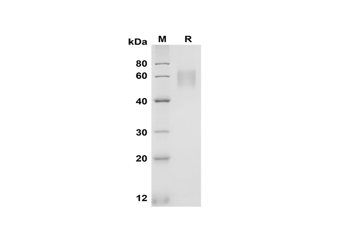 Recombinant chiken IL2/IL-2/Interleukin-2 Protein(His Tag)-产品推荐-1