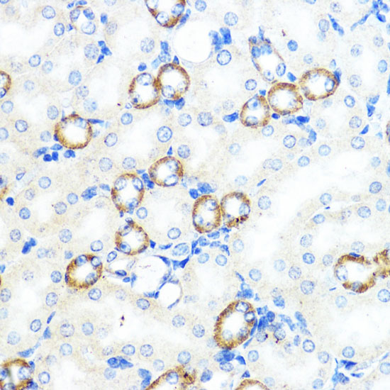 Immunohistochemistry of paraffin-embedded Mouse kidney using NOD1 Polyclonal Antibody at dilution of 1:100 (40x lens).