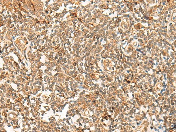 Immunohistochemistry of paraffin-embedded Human tonsil tissue  using POLR1E Polyclonal Antibody at dilution of 1:40(?200)