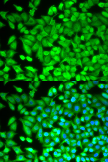 Immunofluorescence analysis of MCF-7 cells using FBP1 Polyclonal Antibody