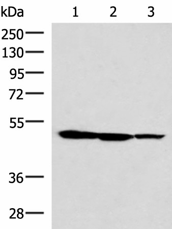 Western blot analysis of HepG2 K562 and A172 cell lysates  using TTC38 Polyclonal Antibody at dilution of 1:1000