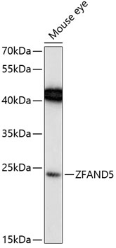 Western blot analysis of extracts of mouse eye using ZFAND5 Polyclonal Antibody at 1:1000 dilution.