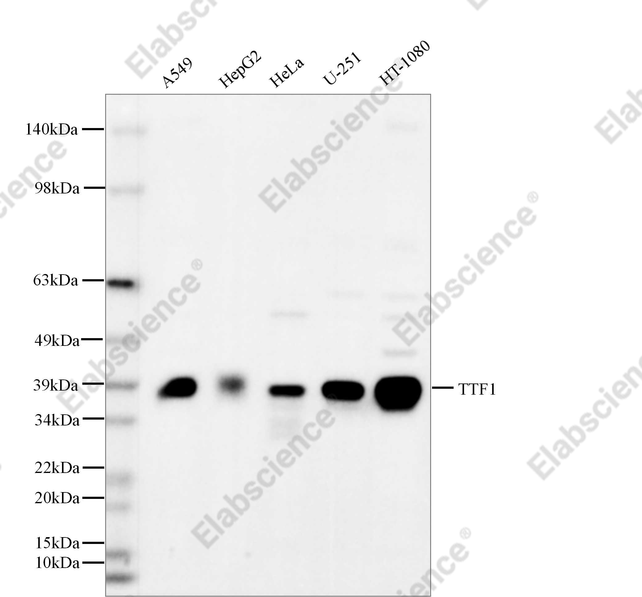 Recombinant TTF1 Monoclonal Antibody - 1