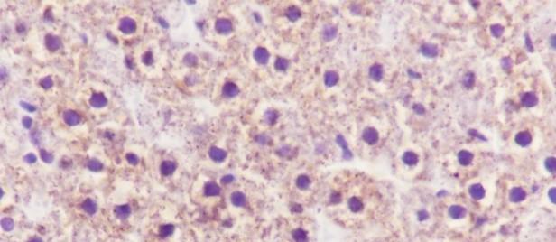 Recombinant CPS1 Monoclonal Antibody - small - 6