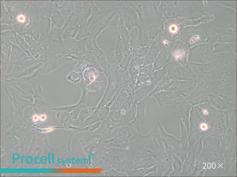 NCI-H196 Cell Complete Medium - 4