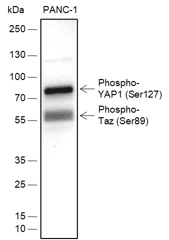 Recombinant Phospho-YAP1 (Ser127) Monoclonal Antibody - small - 2